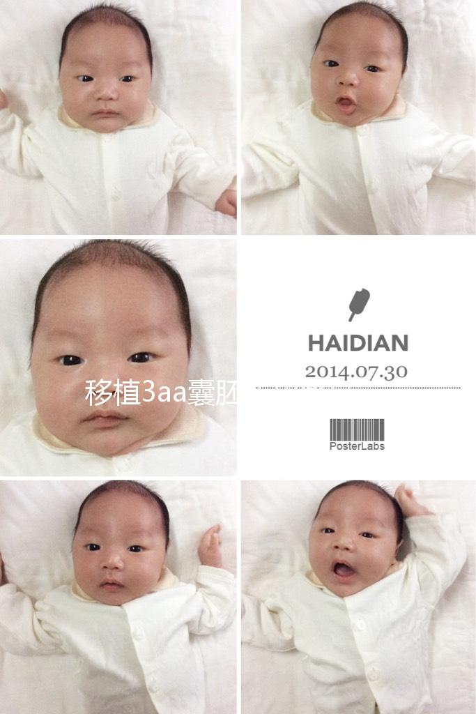 移植3aa囊胚成功率高嗎？詳解質量等級助孕更放心