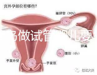 去青島做試管嬰兒要多少錢？