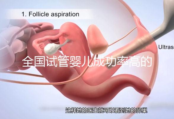 全國試管嬰兒成功率高的醫(yī)院排名,內(nèi)附2023試管費用及成功率參考