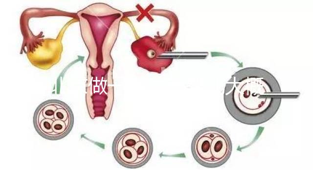 北京做一次試管嬰兒大概花多少錢？2025年價格及明細清單一覽！