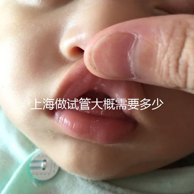 上海做試管大概需要多少費用