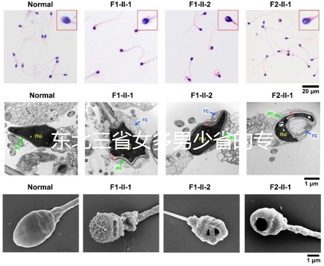 東北三省女多男少省的專業解讀原因1:1真沒開玩笑