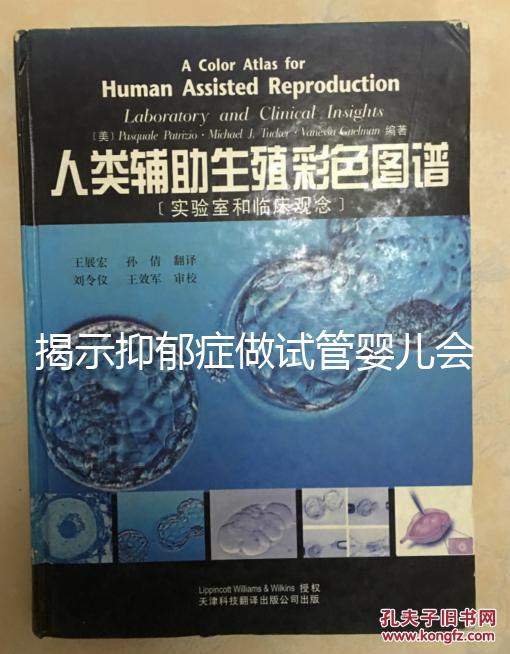 揭示抑郁癥做試管嬰兒會遺傳給女兒，想避免看這個