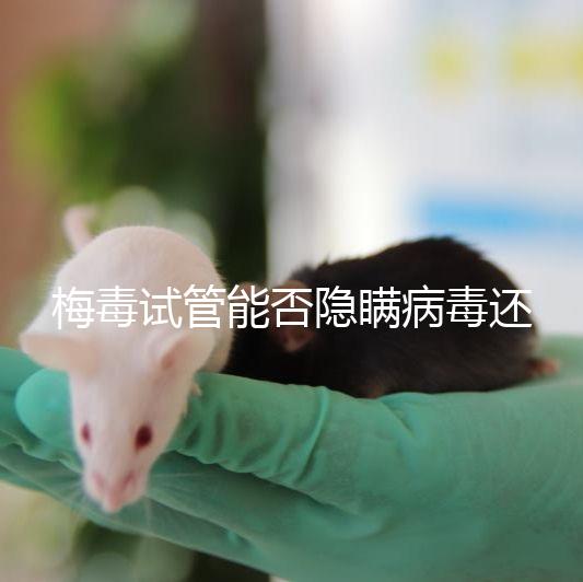 梅毒試管能否隱瞞病毒還沒有建造，備案記錄已經通知