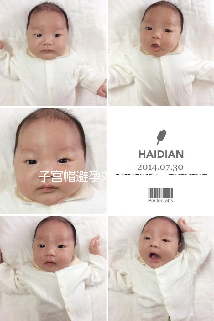 子宮帽避孕效果好嗎?看看網(wǎng)友們有什么經(jīng)驗(yàn)之談