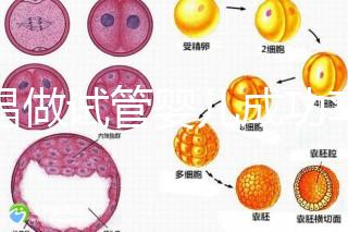 宜昌做試管嬰兒成功率和費(fèi)用多少?先看哪些醫(yī)院能做吧!