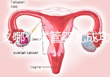 遵義哪個試管嬰兒成功率高？貴州生殖中心醫院2024年排名參考