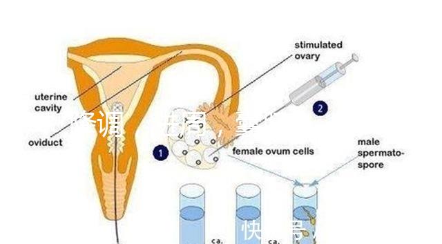 降調，進周，囊胚……這些試管嬰兒助孕術語你都懂嗎？
