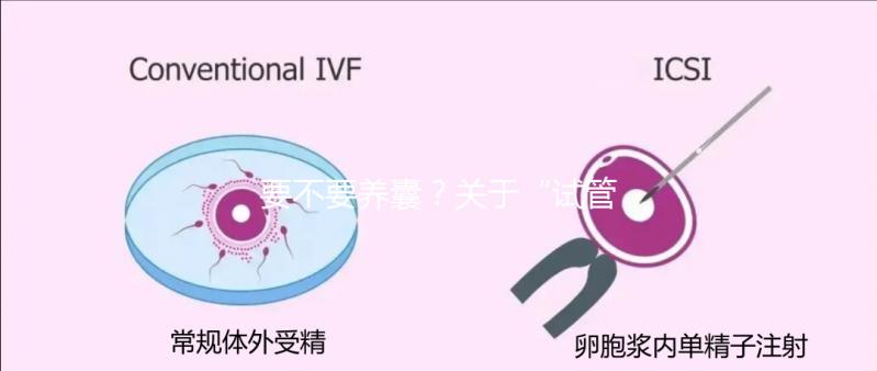 要不要養(yǎng)囊?關(guān)于“試管養(yǎng)囊”你是否會有很多問號?